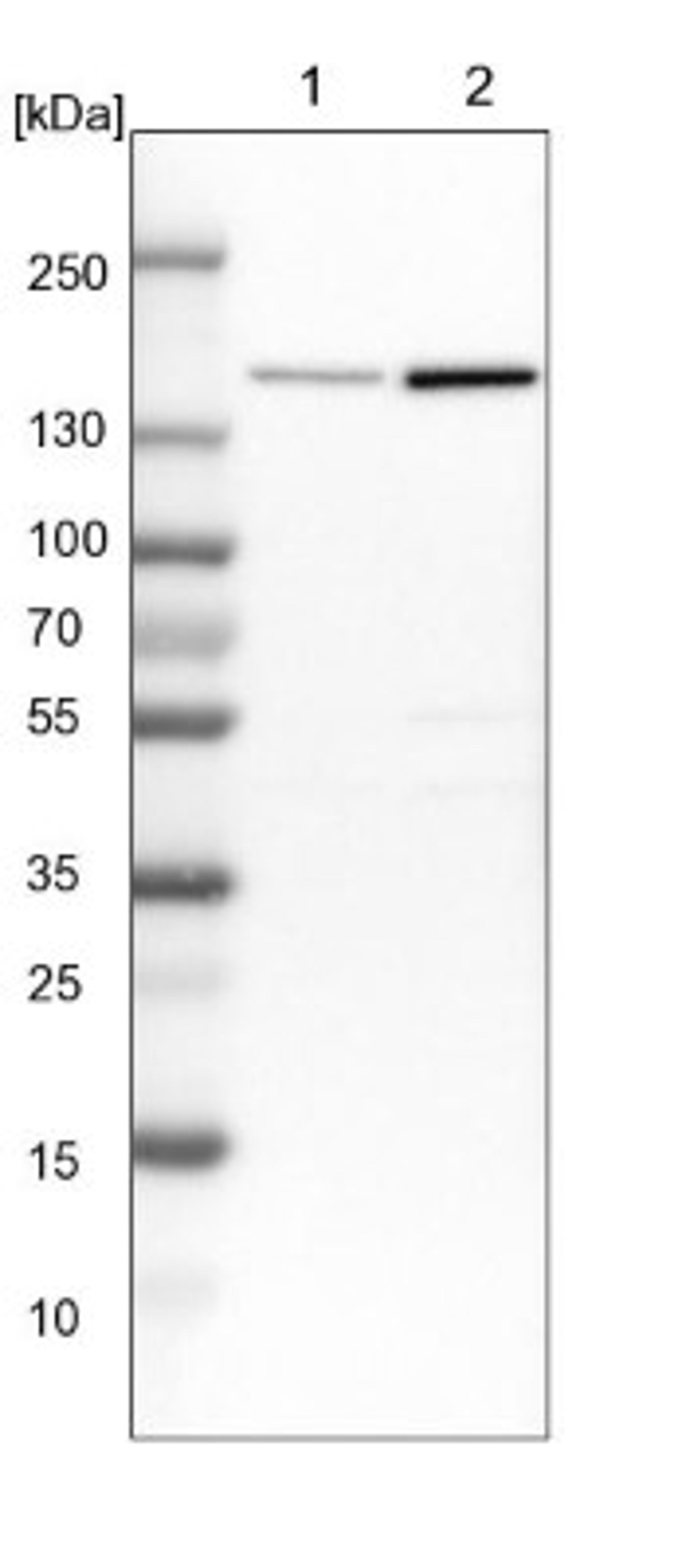 Western Blot: PURL Antibody [NBP1-84691] - Lane 1: NIH-3T3 cell lysate (Mouse embryonic fibroblast cells)<br/>Lane 2: NBT-II cell lysate (Rat Wistar bladder tumour cells)