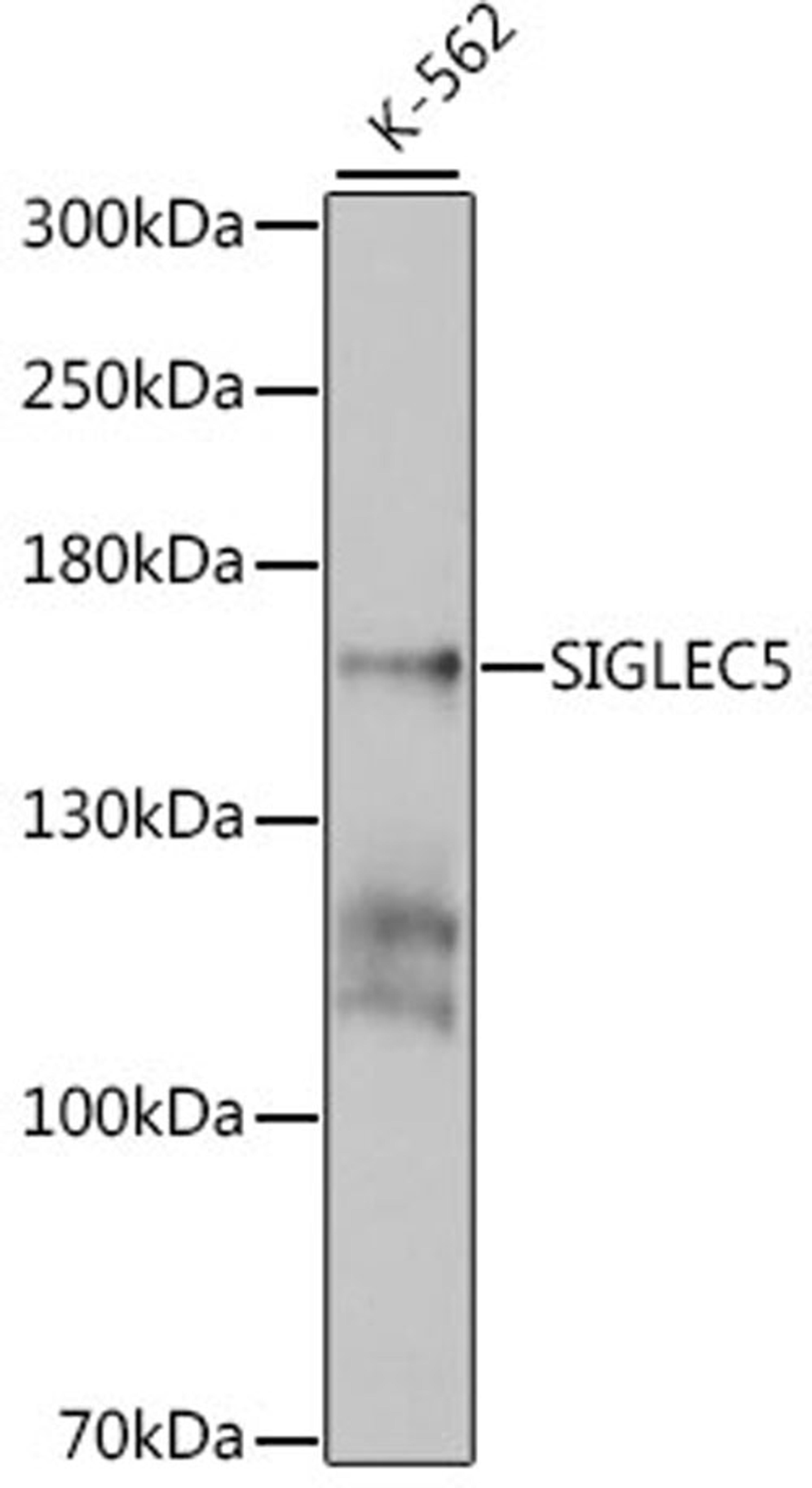 Western blot - SIGLEC5 antibody (A4250)