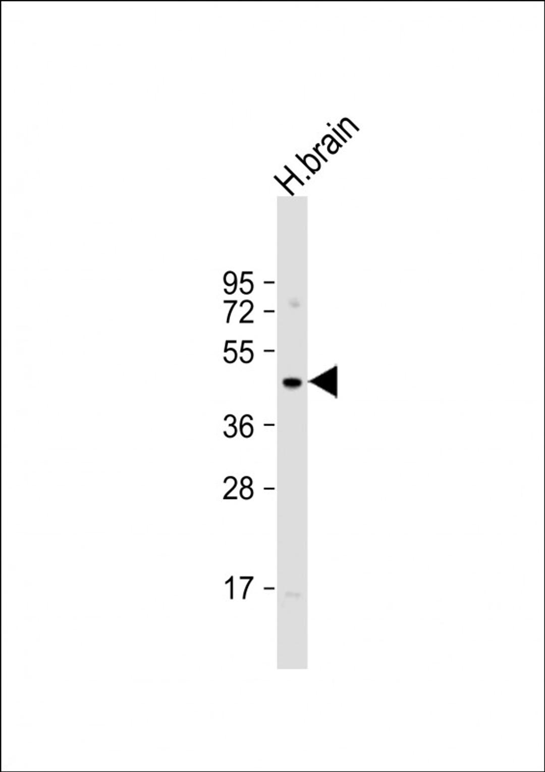 Western Blot at 1:1000 dilution + human brain lysate Lysates/proteins at 20 ug per lane.