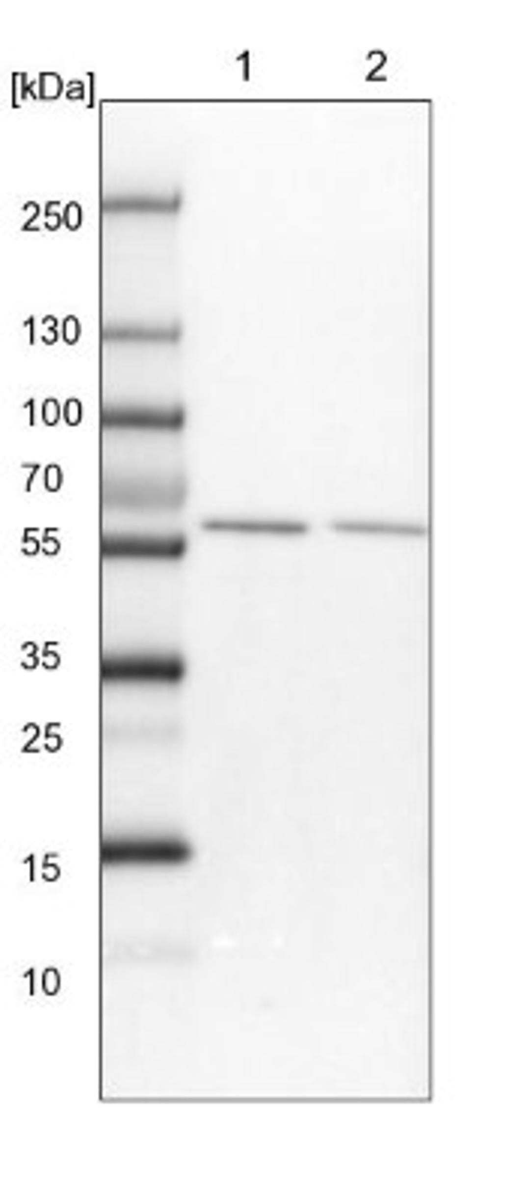 Western Blot: FAM190B Antibody [NBP1-81438] - Lane 1: NIH-3T3 cell lysate (Mouse embryonic fibroblast cells)<br/>Lane 2: NBT-II cell lysate (Rat Wistar bladder tumour cells)