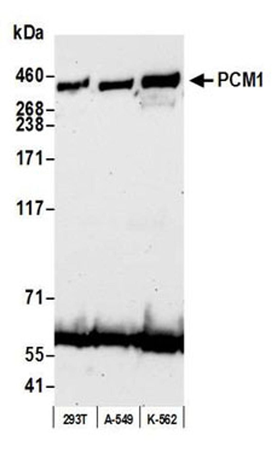 Detection of human PCM1 by western blot.