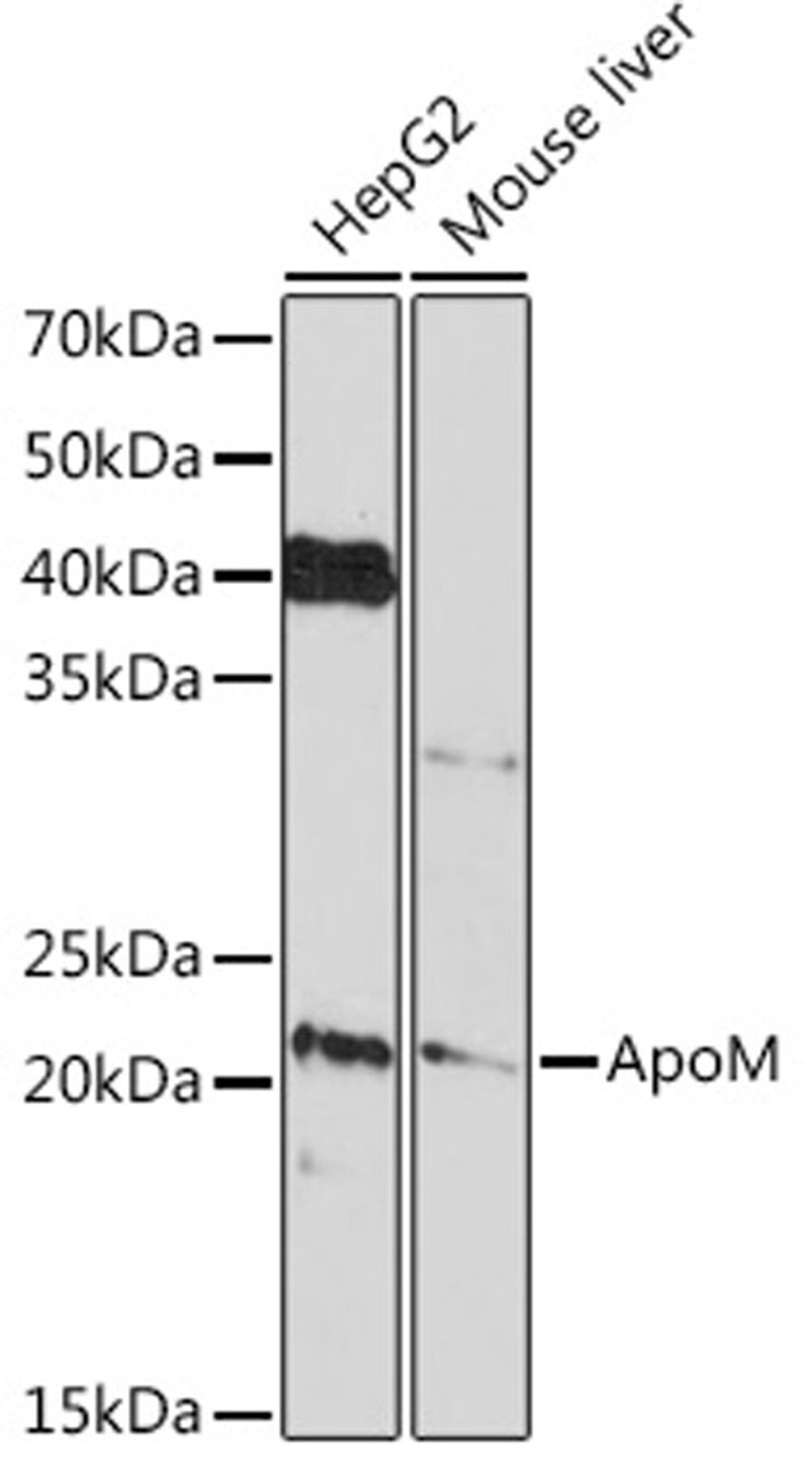 Western blot - ApoM Rabbit mAb (A5144)