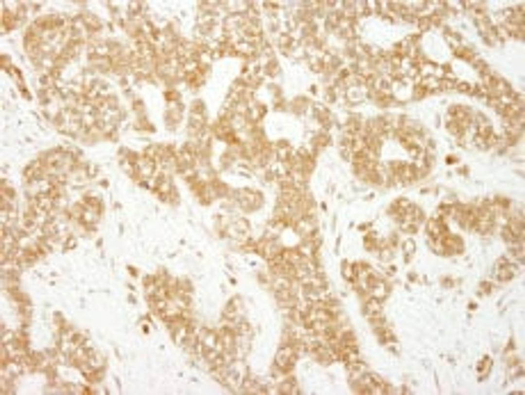 Detection of human EEA1 by immunohistochemistry.