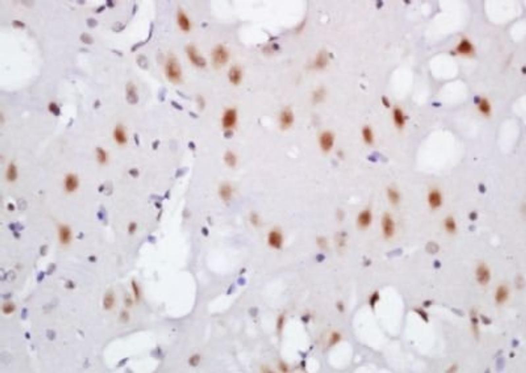 Immunohistochemical analysis of formalin-fixed paraffin embedded rat brain tissue using TNIK (phospho-Ser764) antibody (dilution at 1:200)