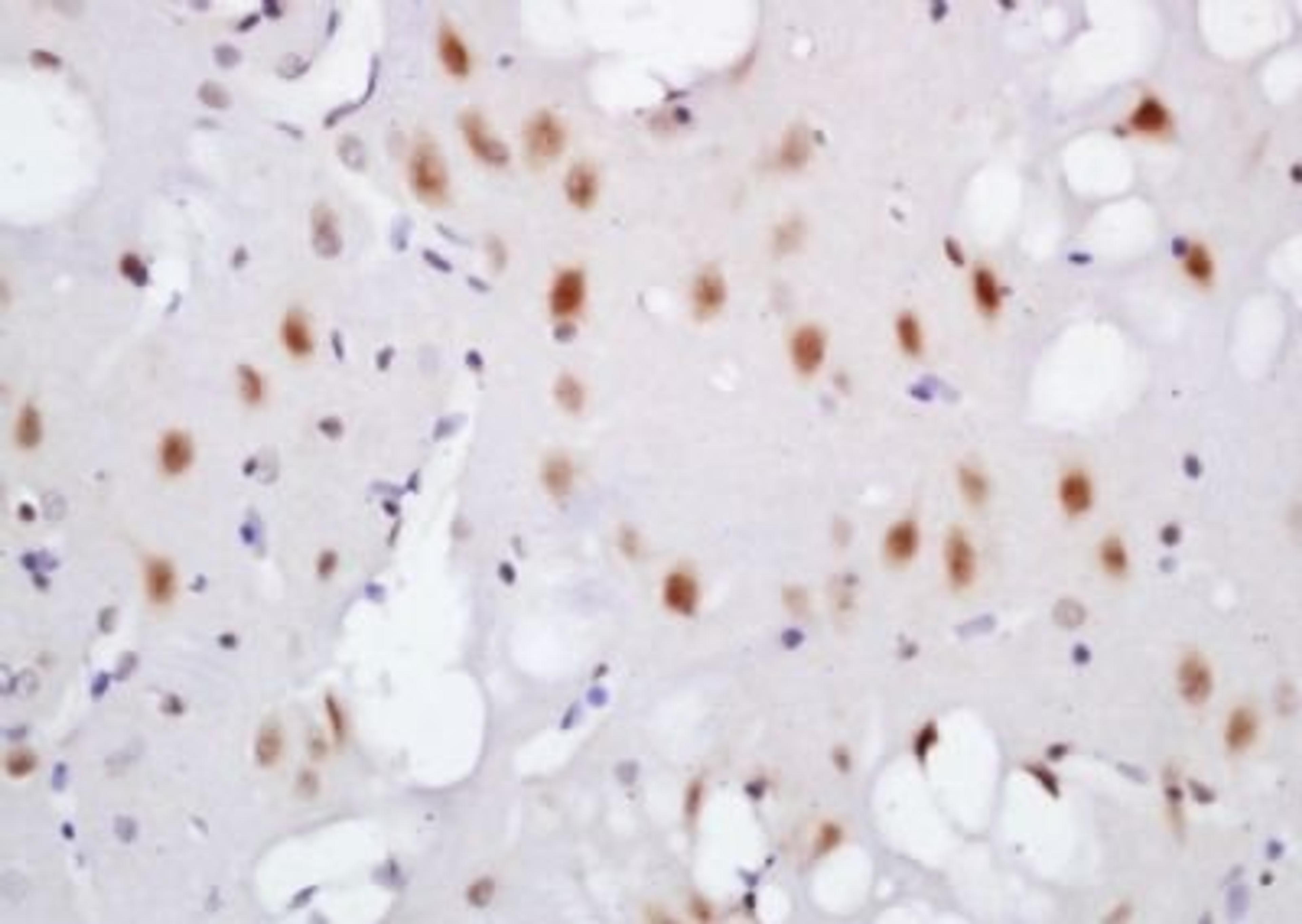 Immunohistochemical analysis of formalin-fixed paraffin embedded rat brain tissue using TNIK (phospho-Ser764) antibody (dilution at 1:200)