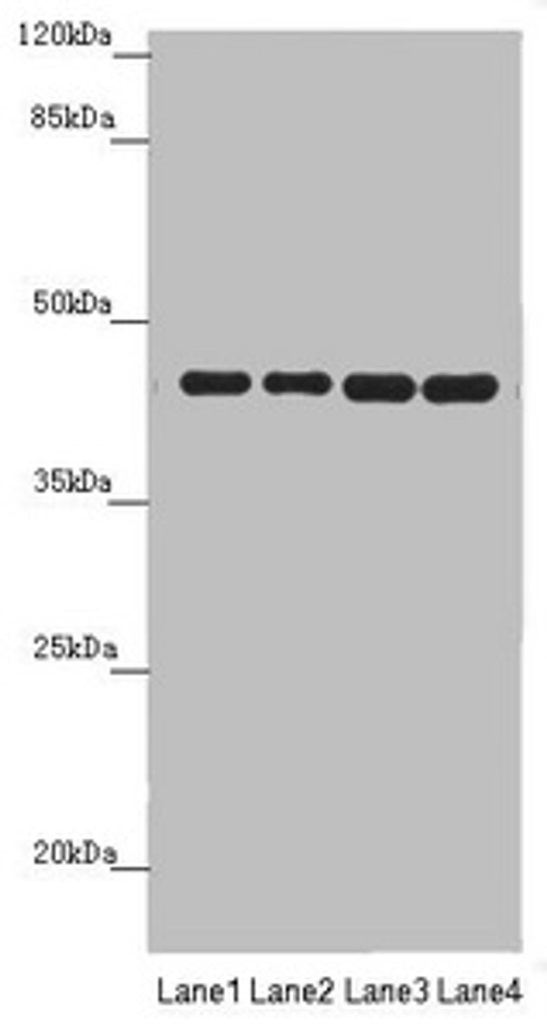 Western blot. All lanes: PDHA2 antibody at 1.62 ug/ml. Lane 1: Mouse gonadal tissue. Lane 2: 293T whole cell lysate. Lane 3: A549 whole cell lysate. Lane 4: HepG2 whole cell lysate. Secondary. Goat polyclonal to rabbit IgG at 1/10000 dilution. Predicted band size: 43 kDa. Observed band size: 43 kDa. 