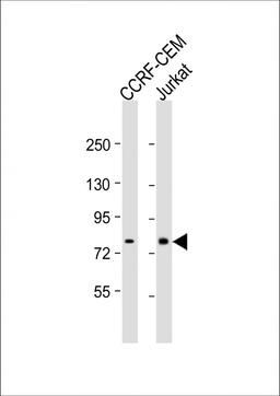 Western Blot at 1:1000 dilution Lane 1: CCRF-CEM whole cell lysate Lane 2: Jurkat whole cell lysate Lysates/proteins at 20 ug per lane.