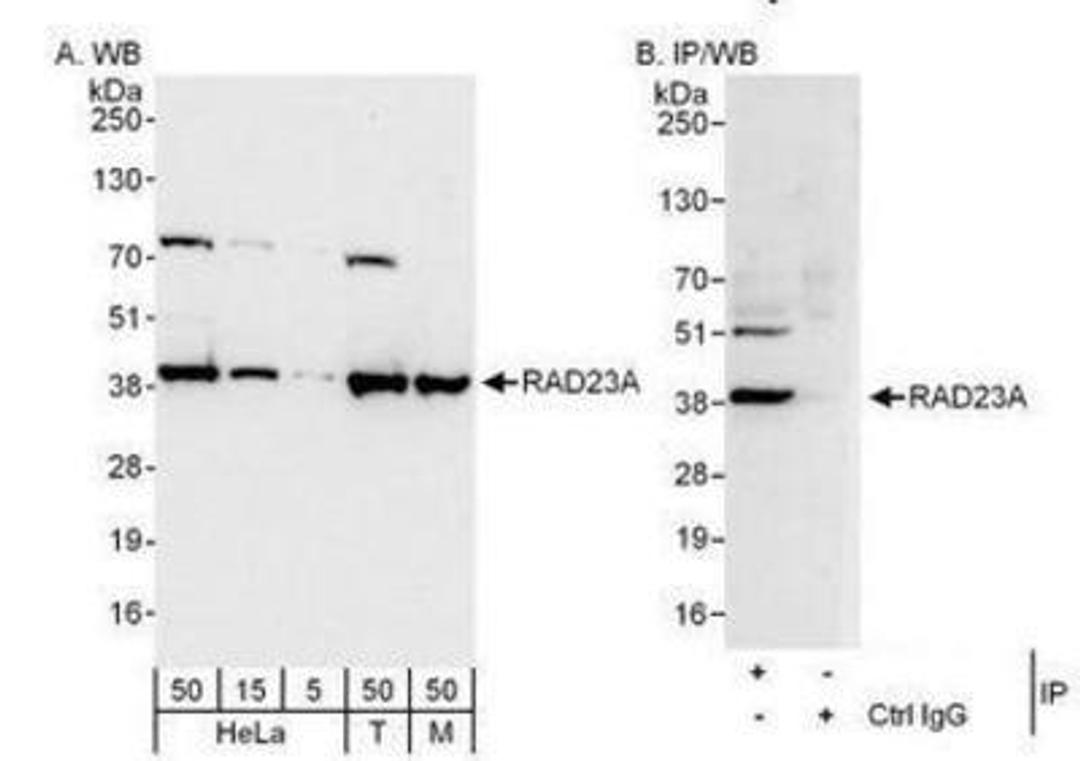 Western Blot: hHR23A Antibody [NBP1-49977] - Detection of Human and Mouse RAD23A by Western Blot (h&m) and Immunoprecipitation (h).  Samples: Whole cell lysate from HeLa (5, 15 and 50 mcg for WB; 1 mg for IP, 20% of IP loaded), 293T (T; 50 mcg), and mouse NIH3T3 (M; 50 mcg) cells.  Antibodies: Affinity purified rabbit anti-RAD23A antibody used for WB at 0.04 mcg/ml (A) and 0.4 mcg/ml (B) and used for IP at 3 mcg/mg lysate. For blotting immunoprecipitated RAD23A was used.  Detection: Chemiluminescence with exposure times of 10 seconds (A and B).