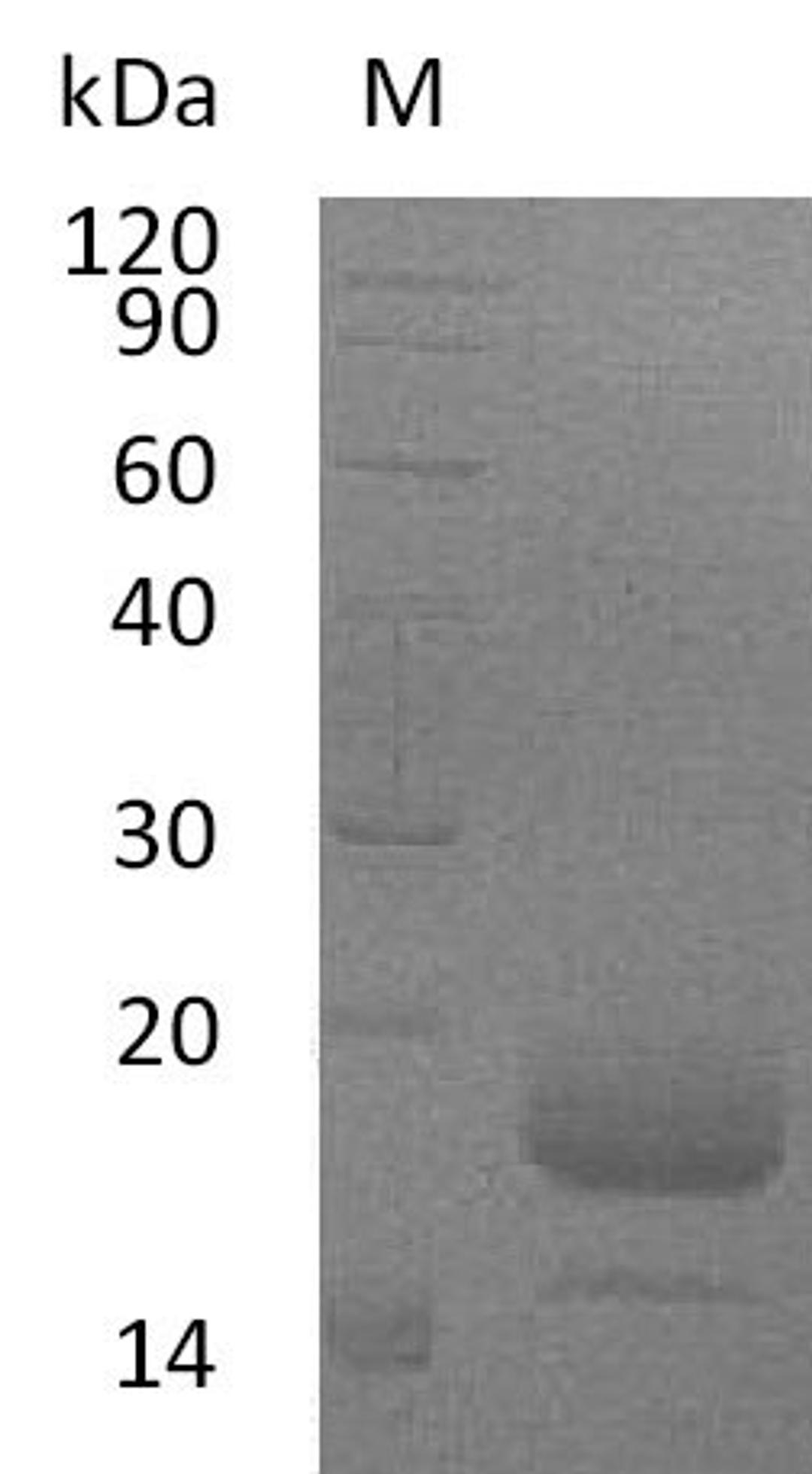 (Tris-Glycine gel) Discontinuous SDS-PAGE (reduced) with 5% enrichment gel and 15% separation gel.