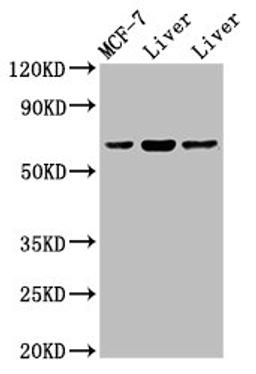 Western Blot. Positive WB detected in: Rat liver tissue, Mouse liver issue. All lanes: PTH1R antibody at 2ug/ml. Secondary. Goat polyclonal to rabbit IgG at 1/50000 dilution. Predicted band size: 67 kDa. Observed band size: 67 kDa.