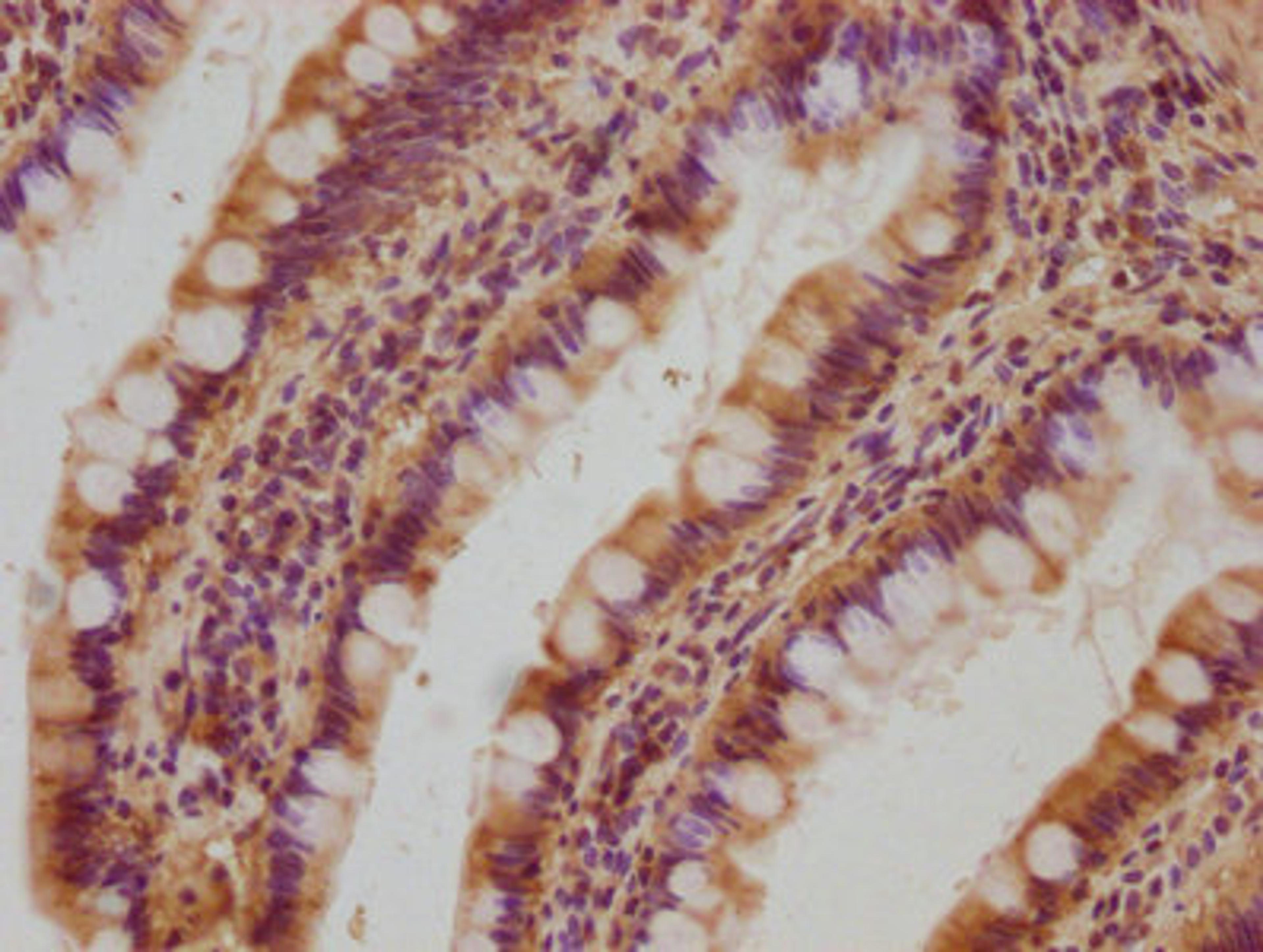 IHC image of CSB-PA861186LA01HU diluted at 1:100 and staining in paraffin-embedded human small intestine tissue performed on a Leica BondTM system. After dewaxing and hydration, antigen retrieval was mediated by high pressure in a citrate buffer (pH 6.0). Section was blocked with 10% normal goat serum 30min at RT. Then primary antibody (1% BSA) was incubated at 4°C overnight. The primary is detected by a biotinylated secondary antibody and visualized using an HRP conjugated SP system.