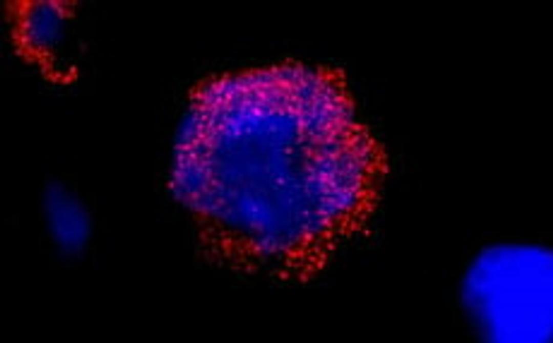 Detection of human BCR by immunocytochemistry.