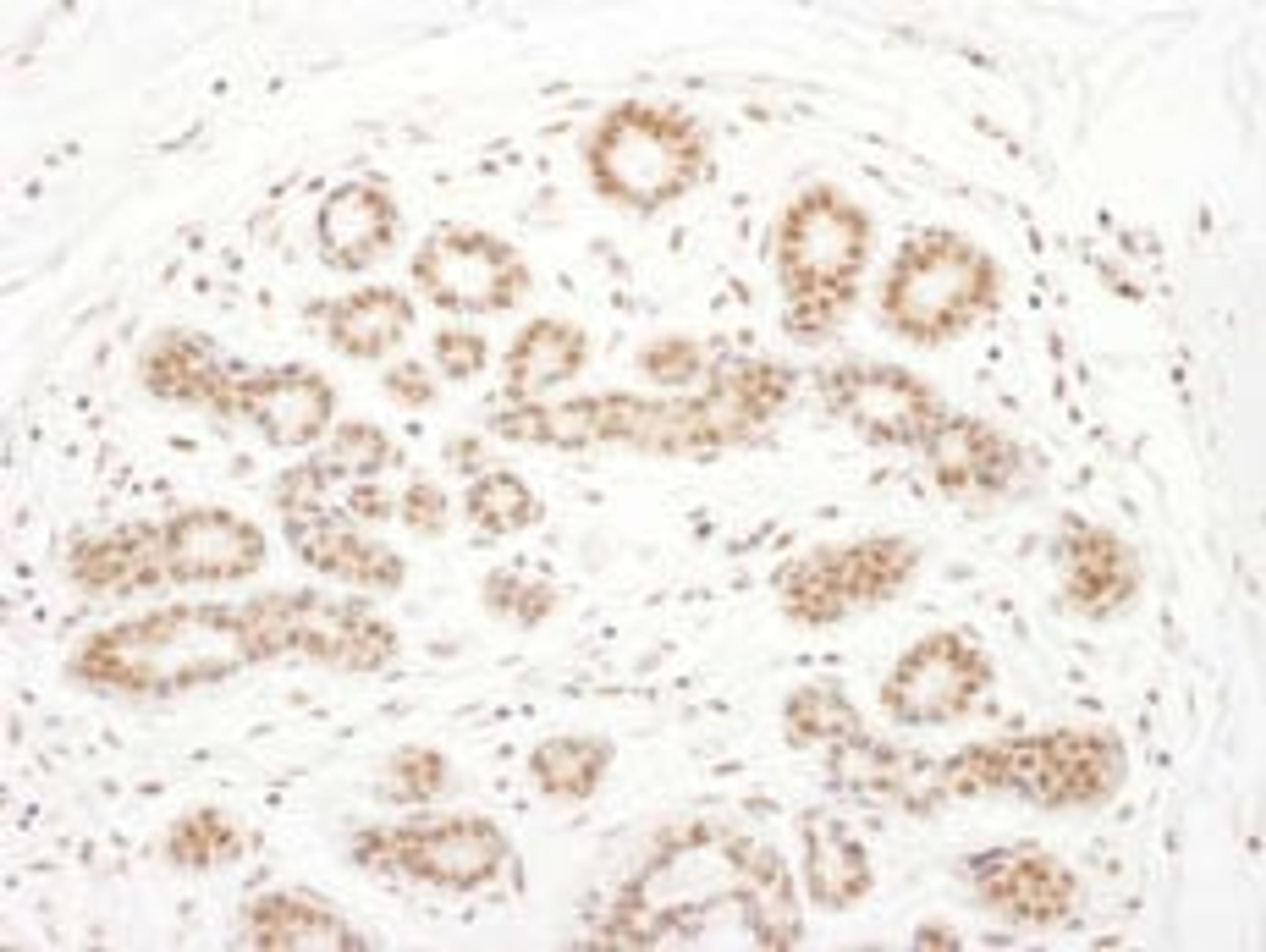 Detection of human RSK3 by immunohistochemistry.