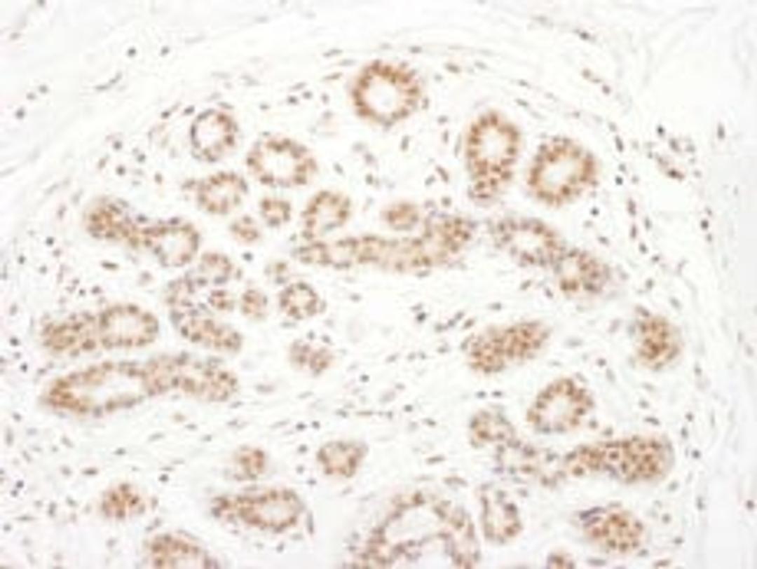 Detection of human RSK3 by immunohistochemistry.