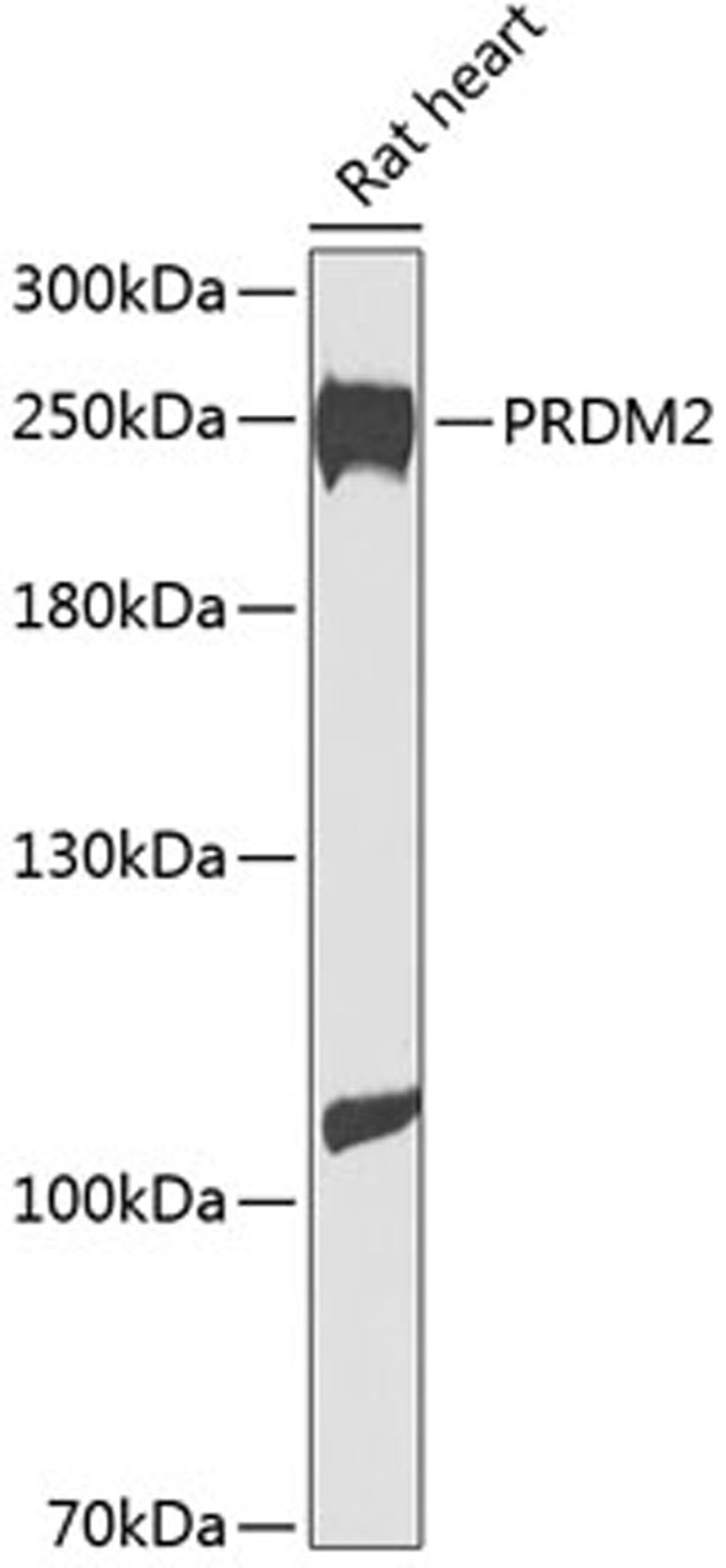 Western blot - PRDM2 antibody (A8565)