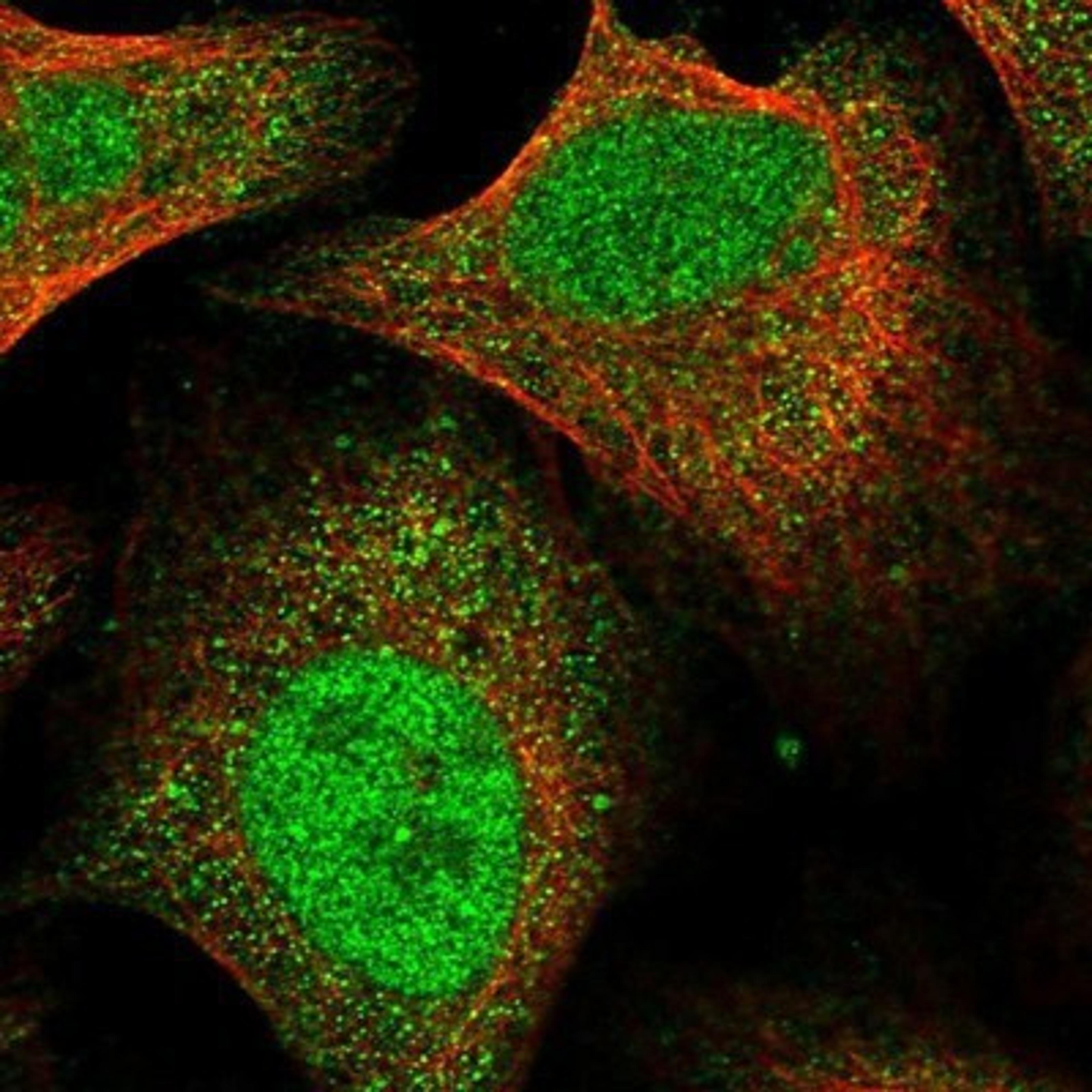 Immunocytochemistry/Immunofluorescence: FTSJD2 Antibody [NBP1-83046] - Staining of human cell line U-2 OS shows positivity in nucleus but not nucleoli & cytoplasm.