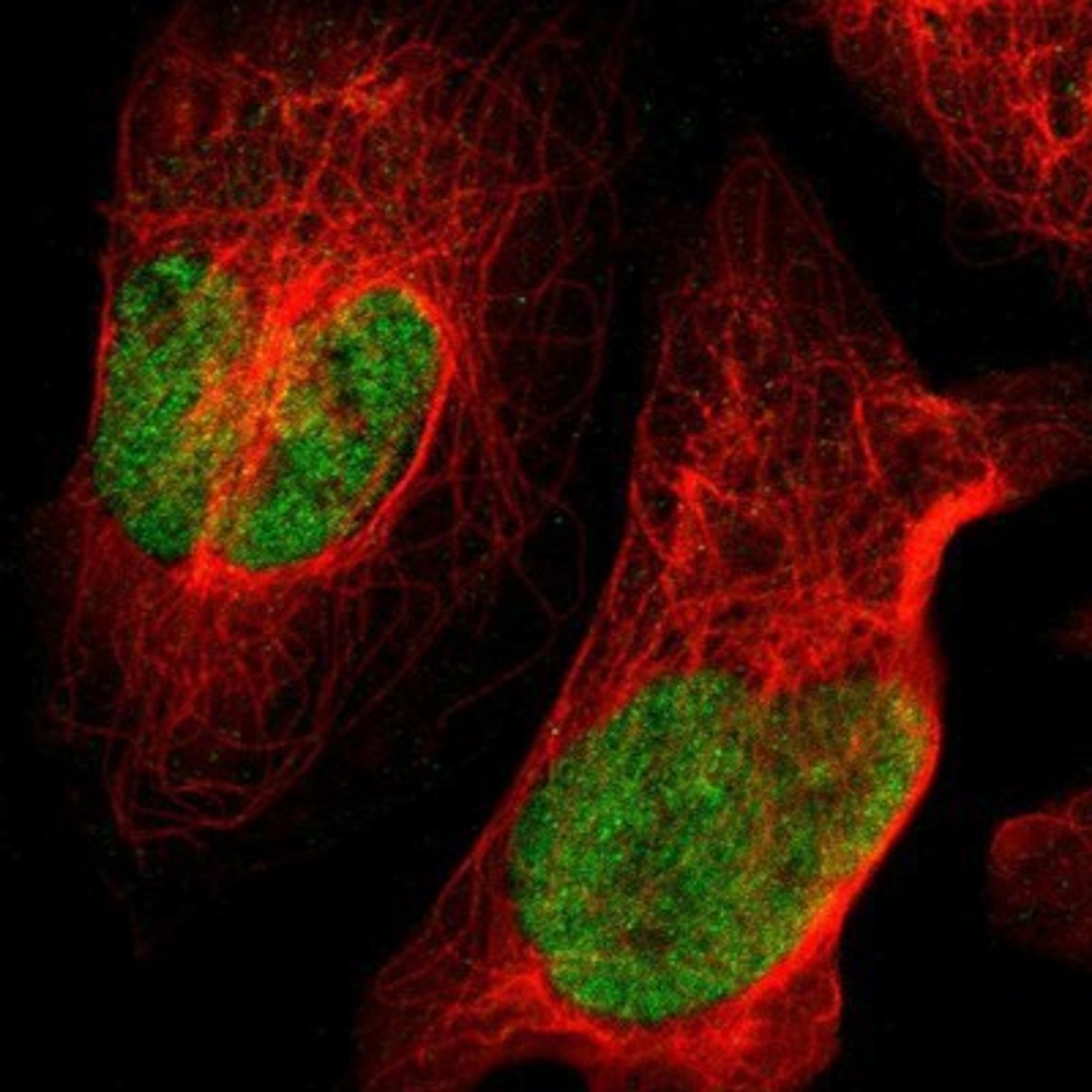 Immunocytochemistry/Immunofluorescence: SOX6 Antibody [NBP1-85811] - Staining of human cell line U-2 OS shows positivity in nuclei but not nucleoli.