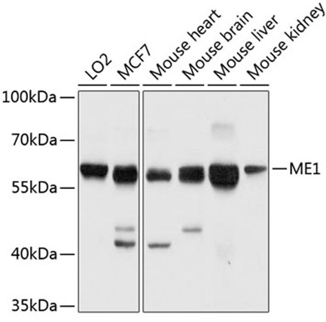 Western blot - ME1 antibody (A3956)