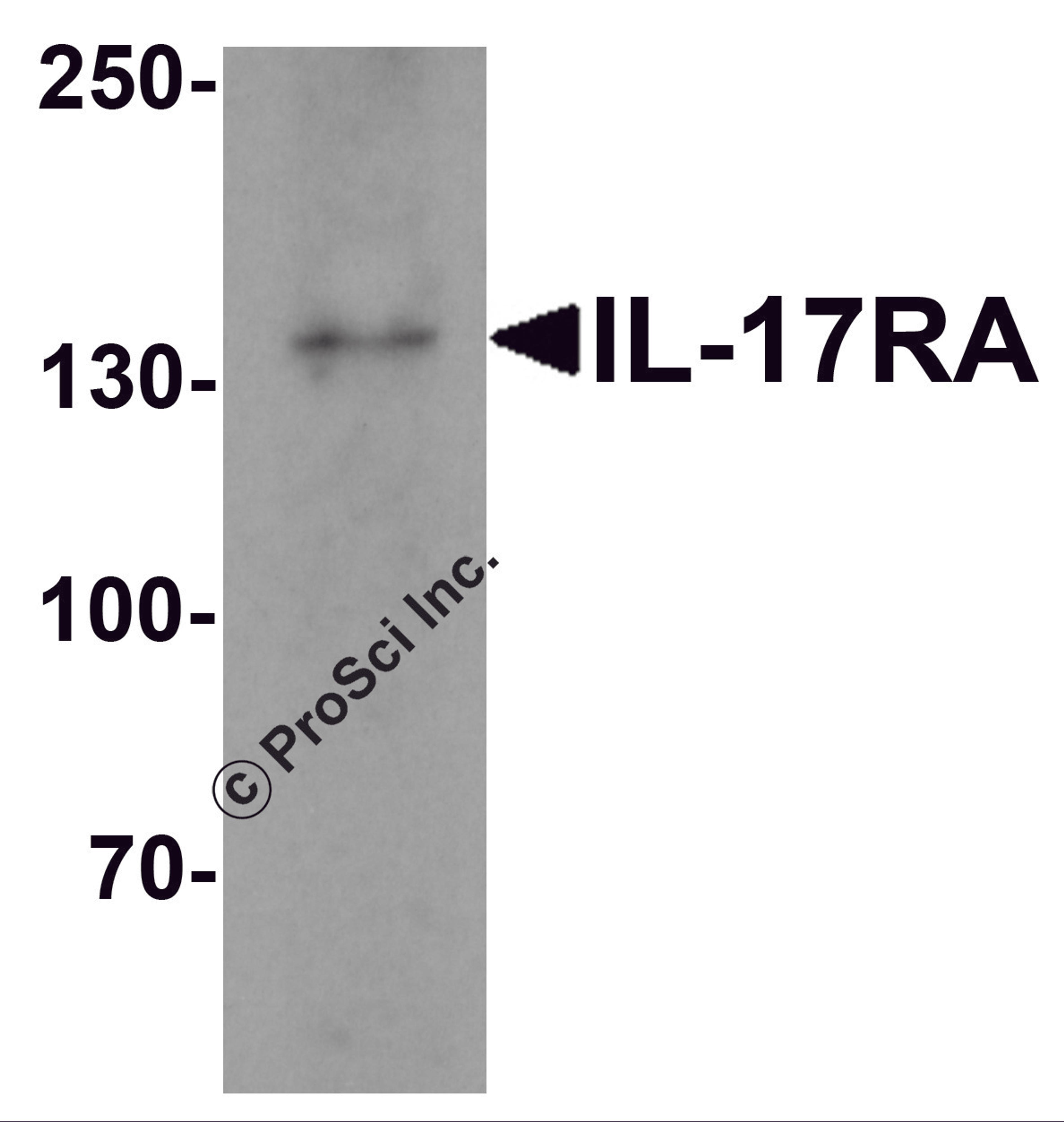 Western blot analysis of IL17RA in A20 cell lysate with IL17RA antibody at 1 &#956;g/mL.