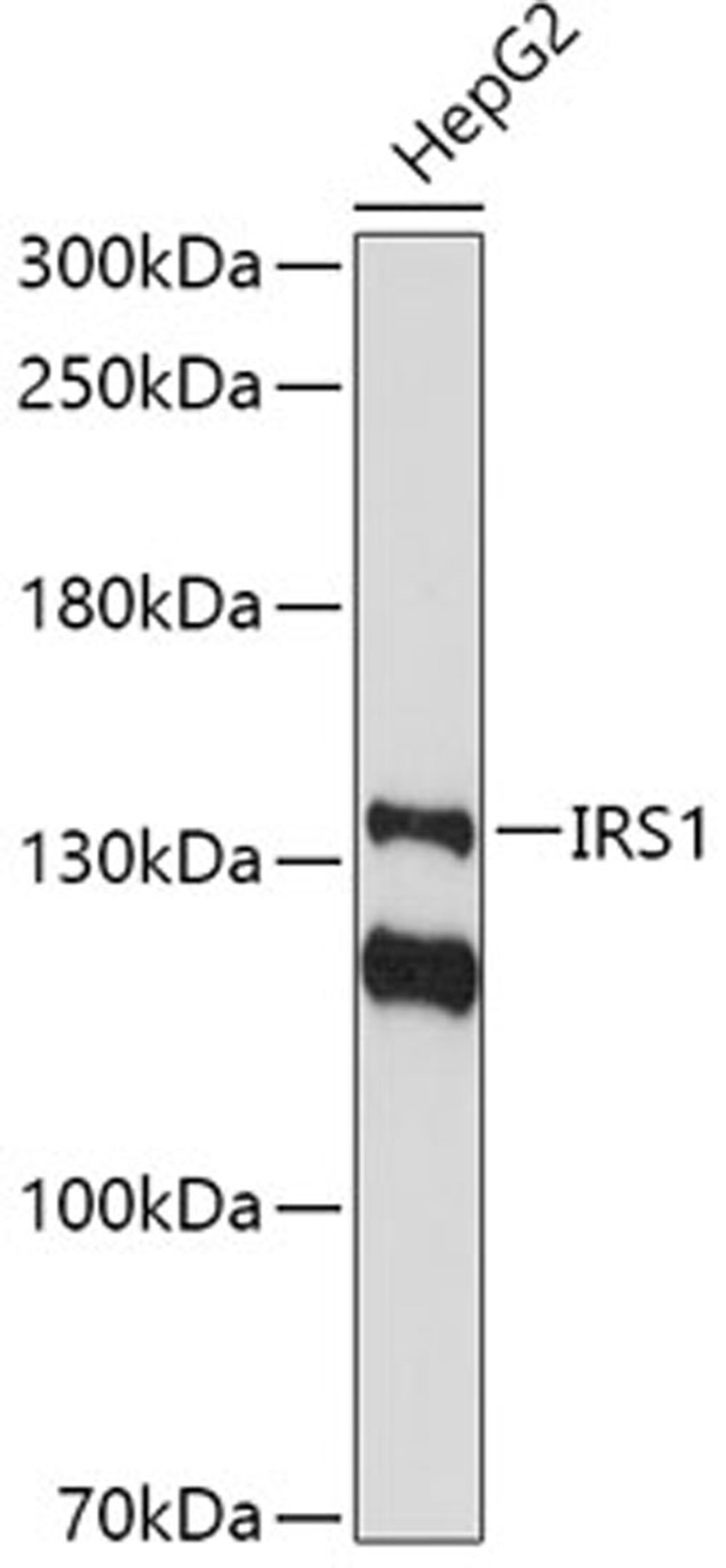 Western blot - IRS1 antibody (A11121)