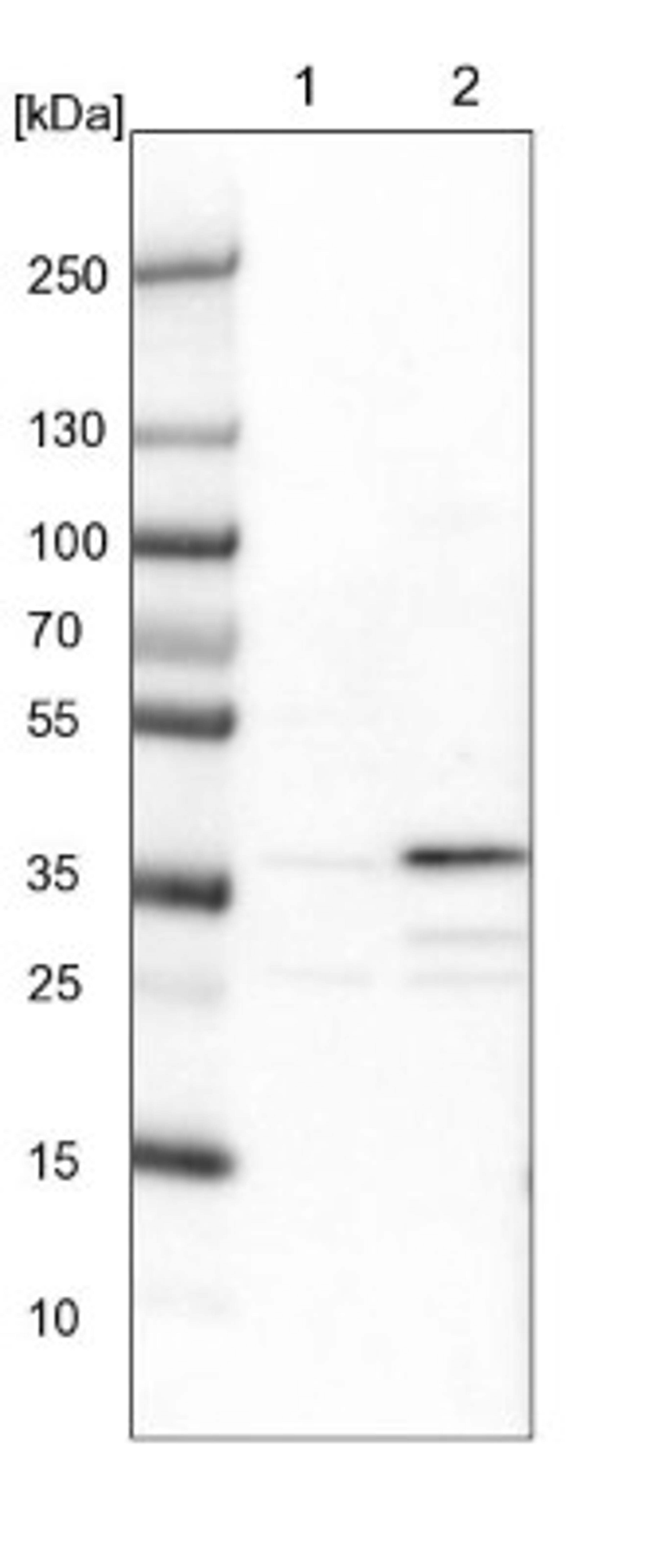 Western Blot: ZNF609 Antibody [NBP1-92634] - Lane 1: NIH-3T3 cell lysate (Mouse embryonic fibroblast cells)<br/>Lane 2: NBT-II cell lysate (Rat Wistar bladder tumour cells)