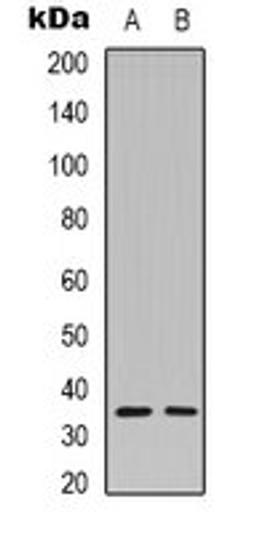 Western blot analysis of Hela (Lane 1), MCF7 (Lane 2) whole cell lysates using Caspase 3 p12 antibody