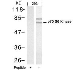 Western blot analysis of lysed extracts from 293 cells using p70 S6 Kinase (Ab-421).