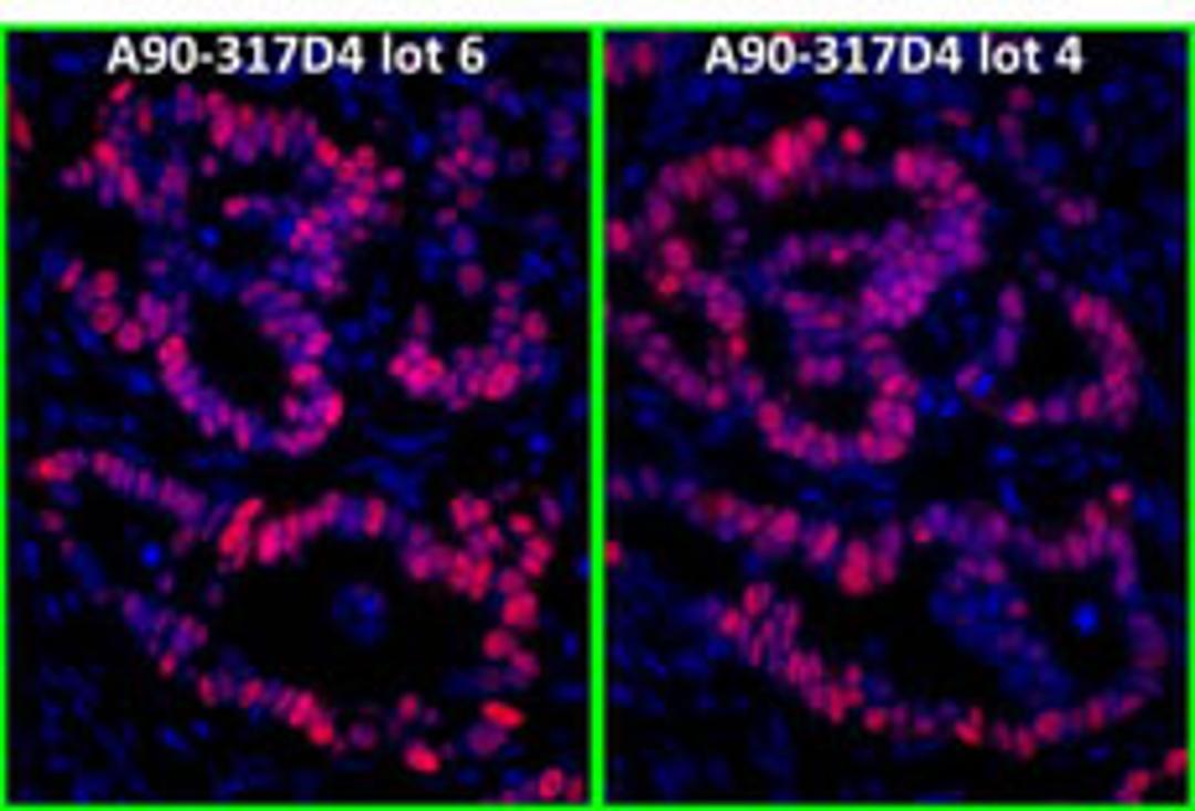 Detection of human p53 by immunofluorescence.