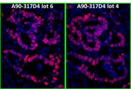 Detection of human p53 by immunofluorescence.