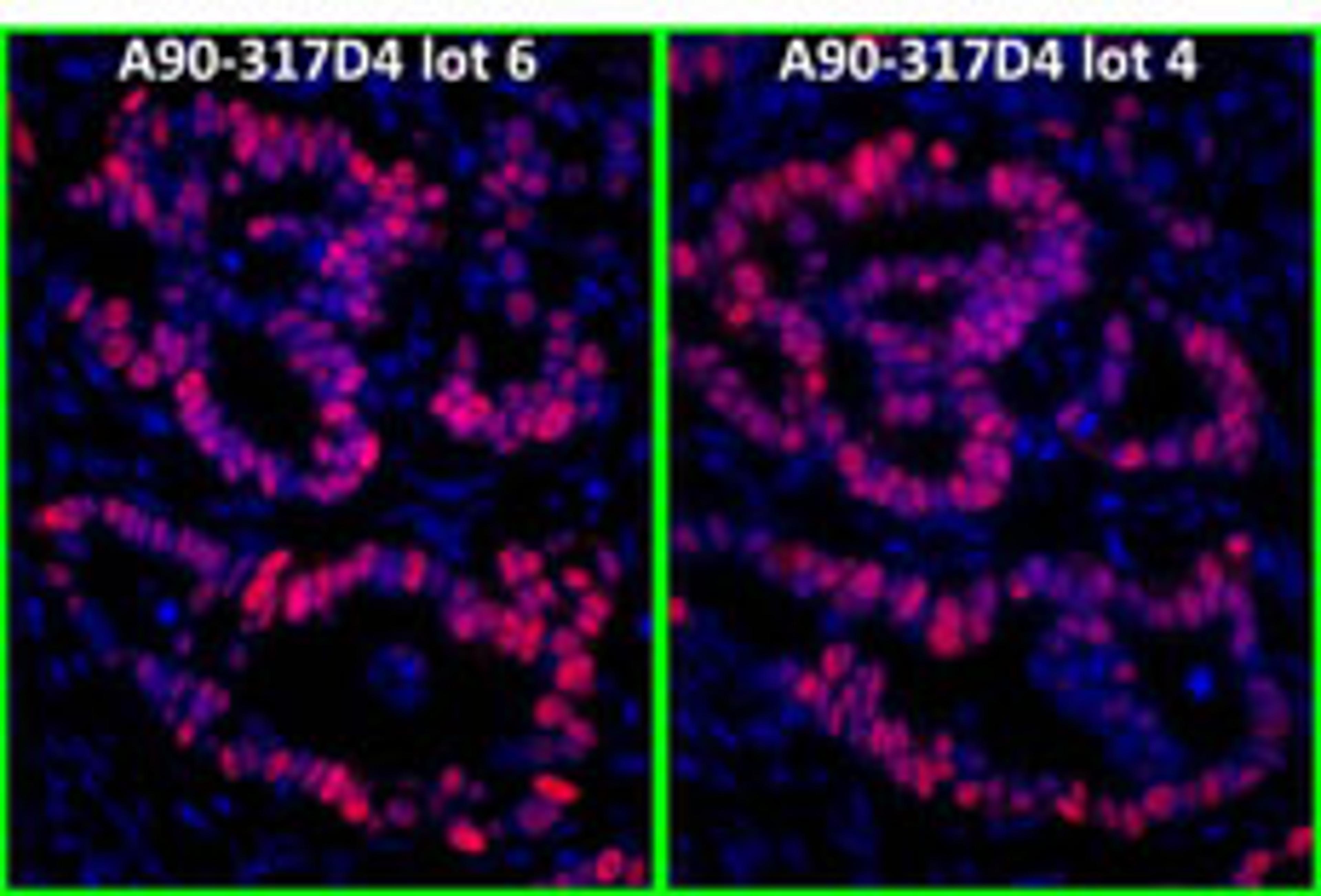 Detection of human p53 by immunofluorescence.