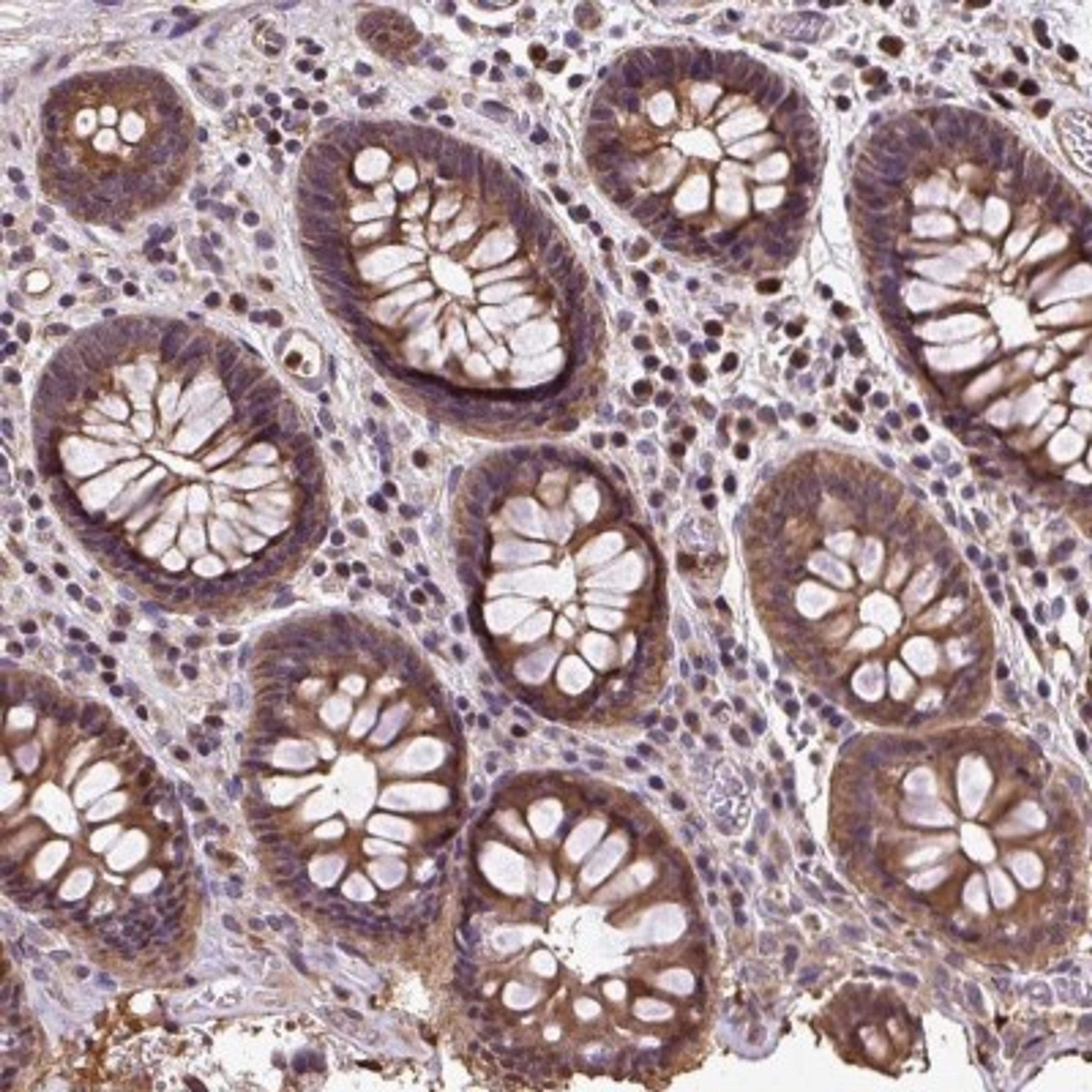 Immunohistochemistry: PUS7L Antibody [NBP2-31630] - Staining of human colon shows moderate cytoplasmic positivity in glandular cells.