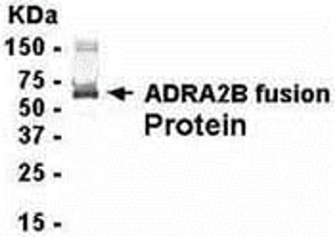 E coli-derived fusion protein as test antigen. Affinity-purified IgY dilution: 1:2000, Goat anti-IgY-HRP dilution: 1:1000. Colorimetric method for signal development.