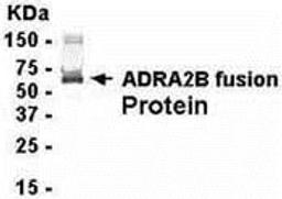 E coli-derived fusion protein as test antigen. Affinity-purified IgY dilution: 1:2000, Goat anti-IgY-HRP dilution: 1:1000. Colorimetric method for signal development.