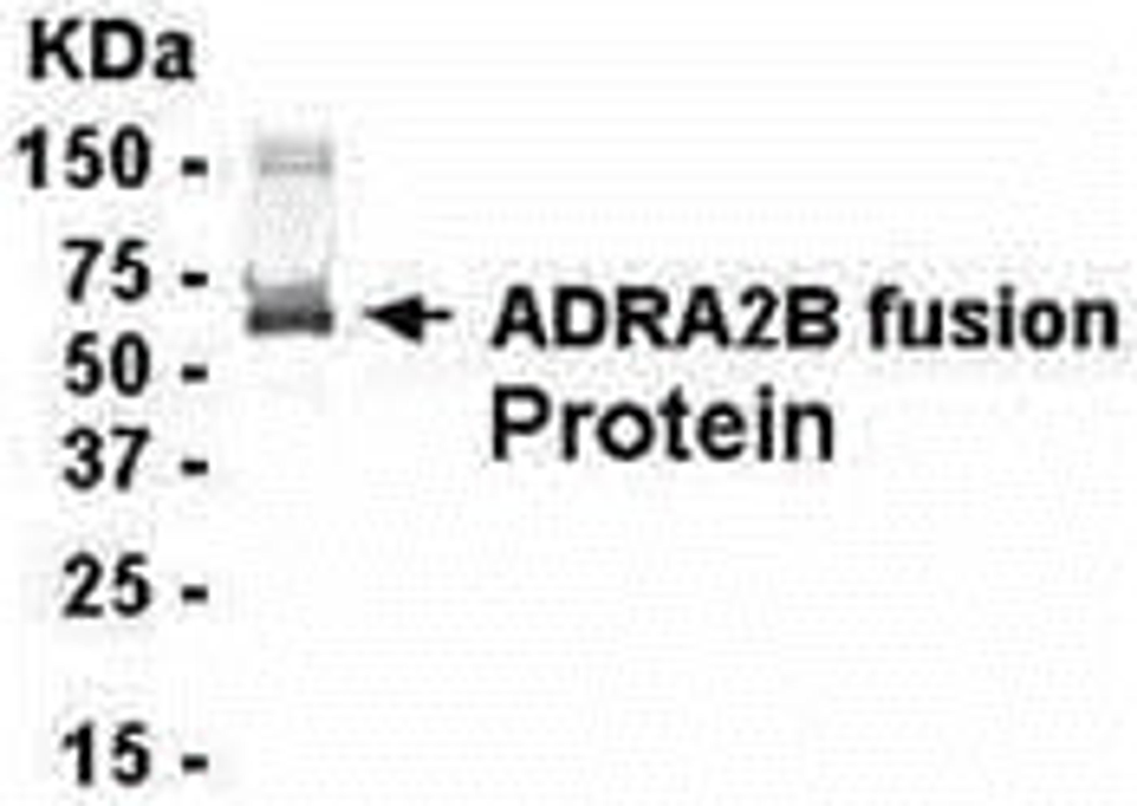 E coli-derived fusion protein as test antigen. Affinity-purified IgY dilution: 1:2000, Goat anti-IgY-HRP dilution: 1:1000. Colorimetric method for signal development.