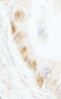 Detection of human DNA Ligase 1 by immunohistochemistry.