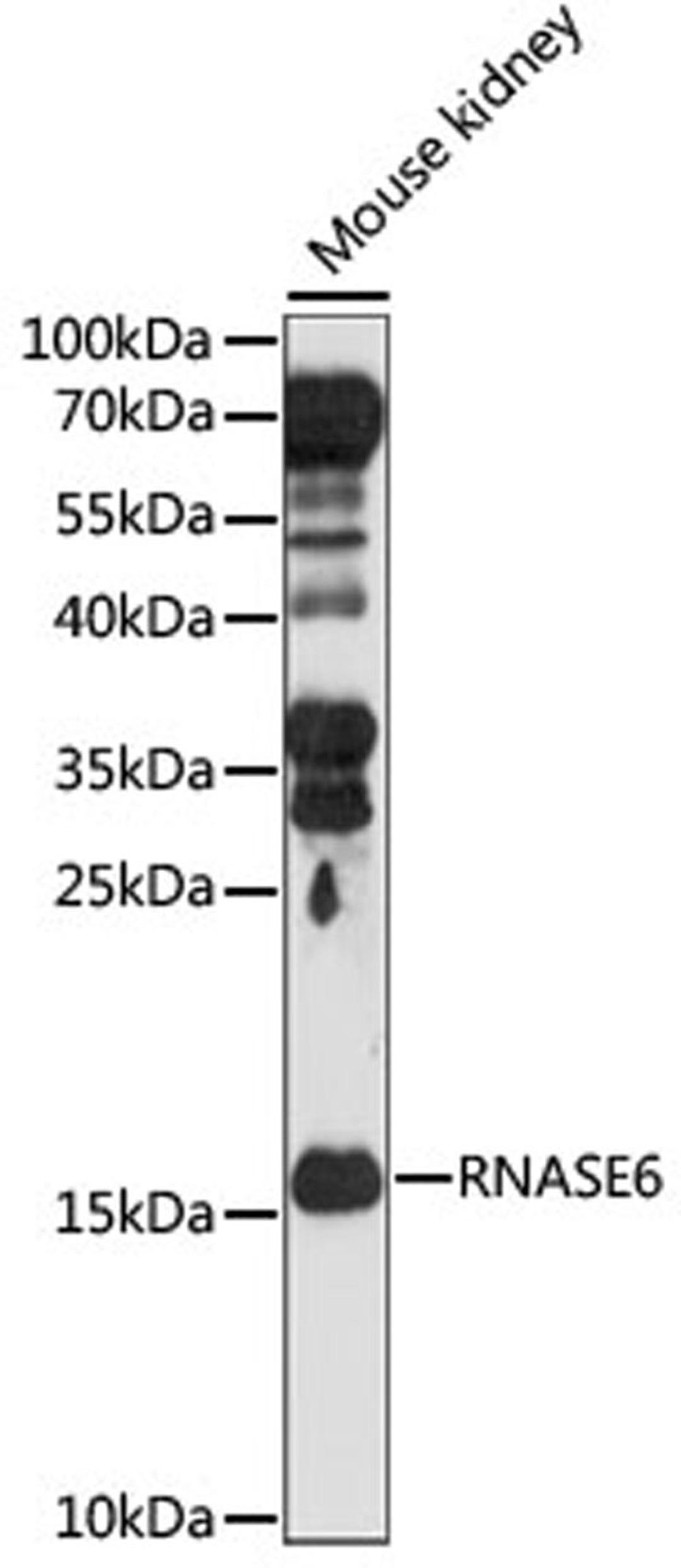 Western blot - RNASE6 antibody (A15312)