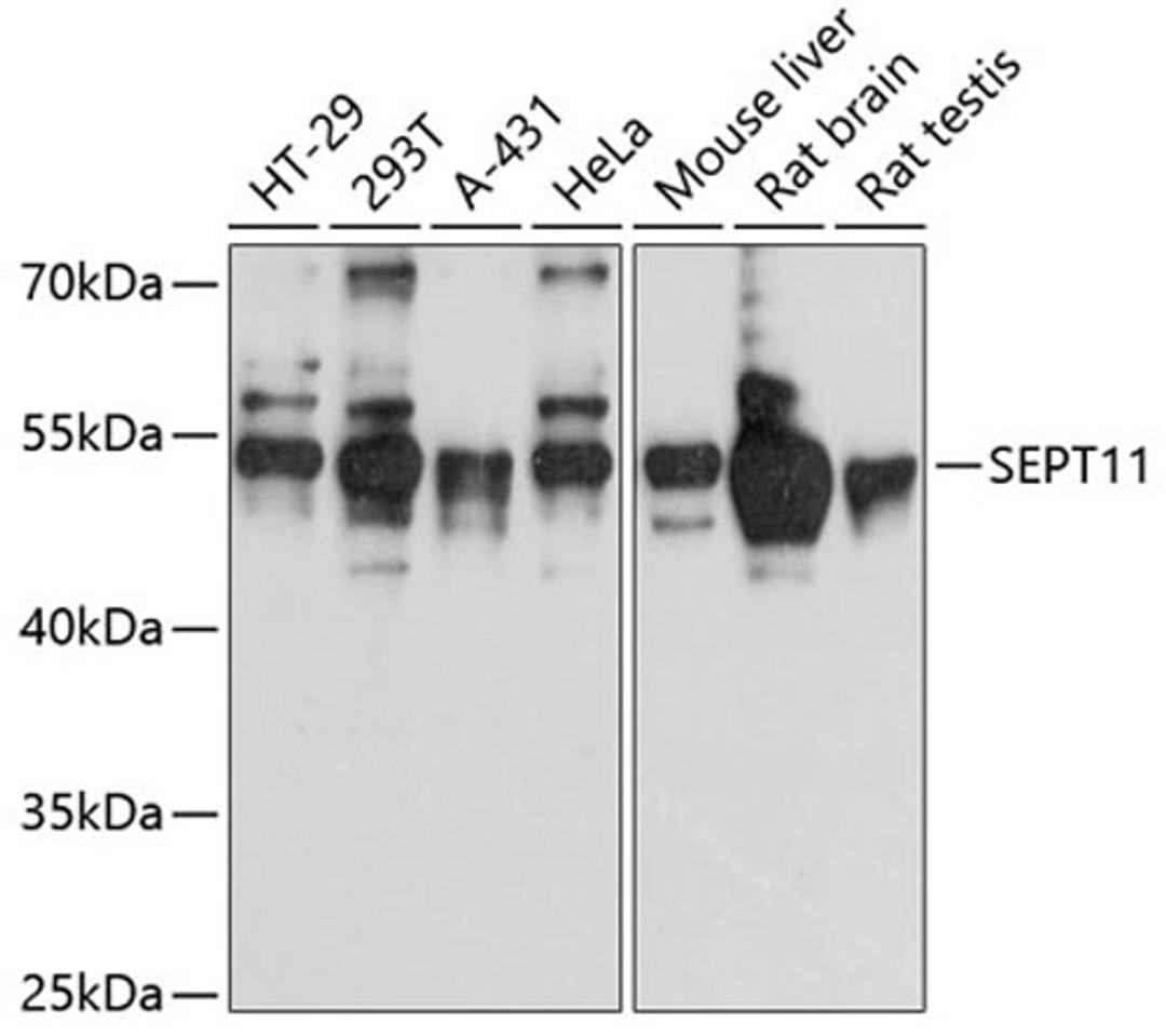 Western blot - SEPT11 antibody (A12189)