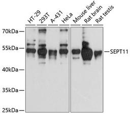 Western blot - SEPT11 antibody (A12189)