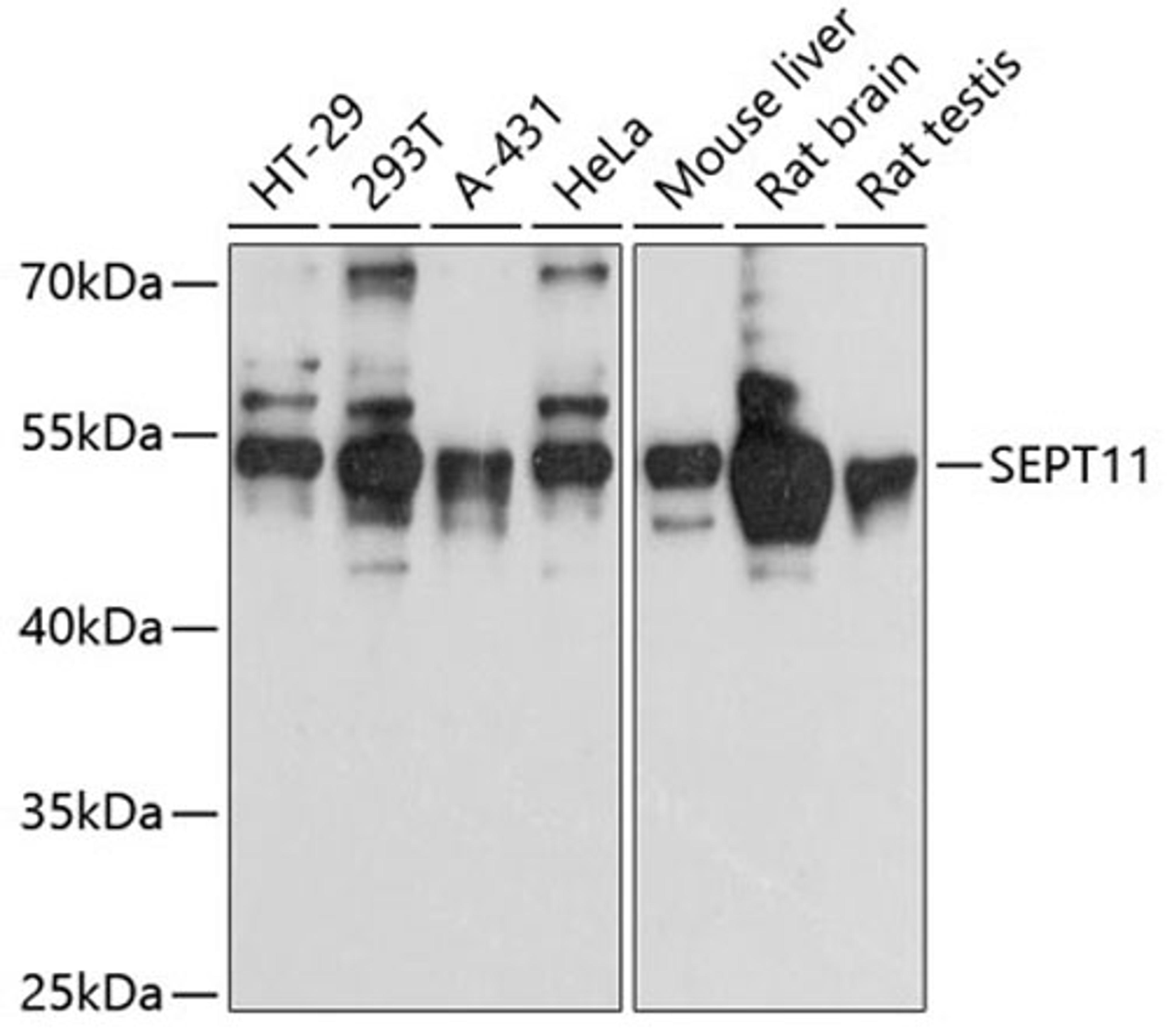 Western blot - SEPT11 antibody (A12189)