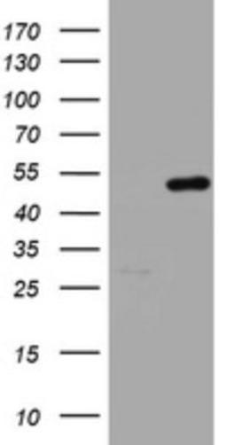 Western Blot: HMBS Antibody (3F4) [NBP2-45976] - Analysis of HEK293T cells were transfected with the pCMV6-ENTRY control (Left lane) or pCMV6-ENTRY HMBS.