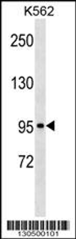 Western blot analysis in K562 cell line lysates (35ug/lane).This demonstrates the KIT antibody detected the KIT protein (arrow).