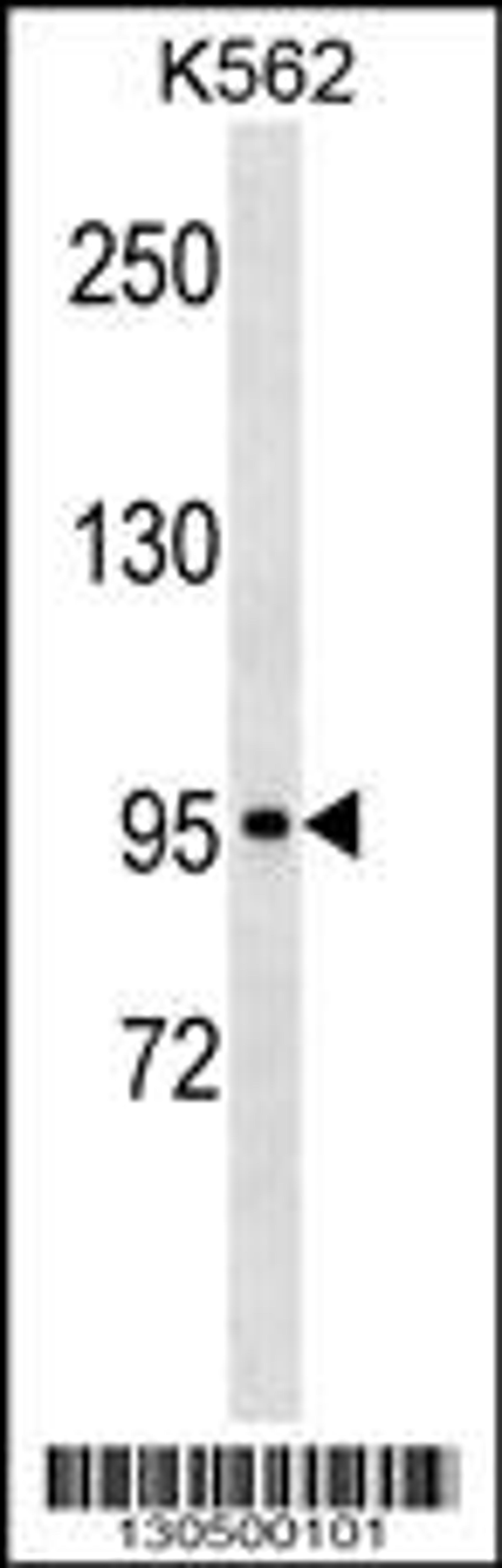 Western blot analysis in K562 cell line lysates (35ug/lane).This demonstrates the KIT antibody detected the KIT protein (arrow).