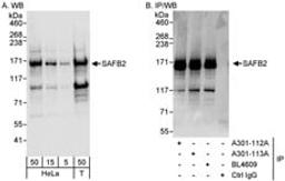 Detection of human SAFB2 by western blot and immunoprecipitation.