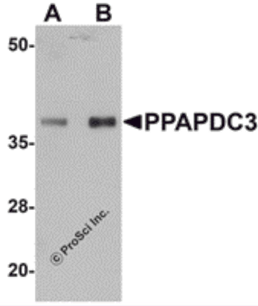 Western blot analysis of PPAPDC3 in mouse heart tissue lysate with PPAPDC3 antibody at (A) 1 and (B) 2 &#956;g/mL.