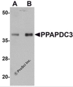 Western blot analysis of PPAPDC3 in mouse heart tissue lysate with PPAPDC3 antibody at (A) 1 and (B) 2 μg/mL.