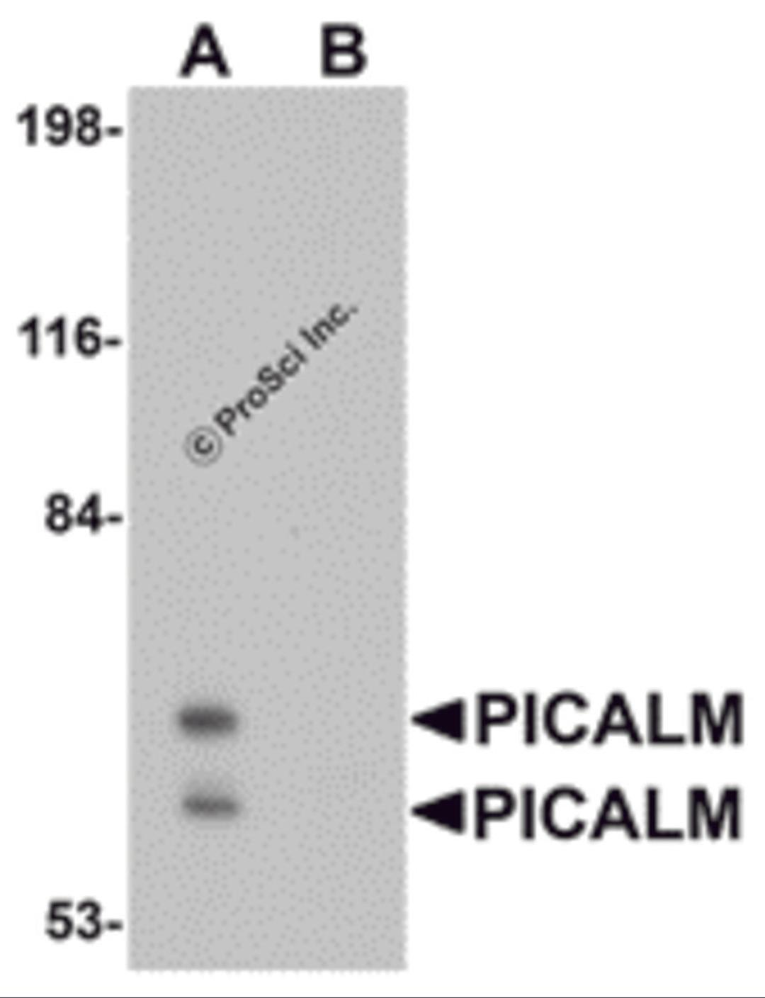 Western blot analysis of PICALM in EL4 cell lysate with PICALM antibody at 1 μg/mL in (A) the absence and (B) the presence of blocking peptide.