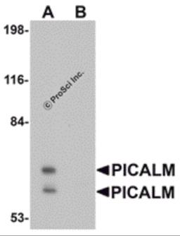Western blot analysis of PICALM in EL4 cell lysate with PICALM antibody at 1 μg/mL in (A) the absence and (B) the presence of blocking peptide.