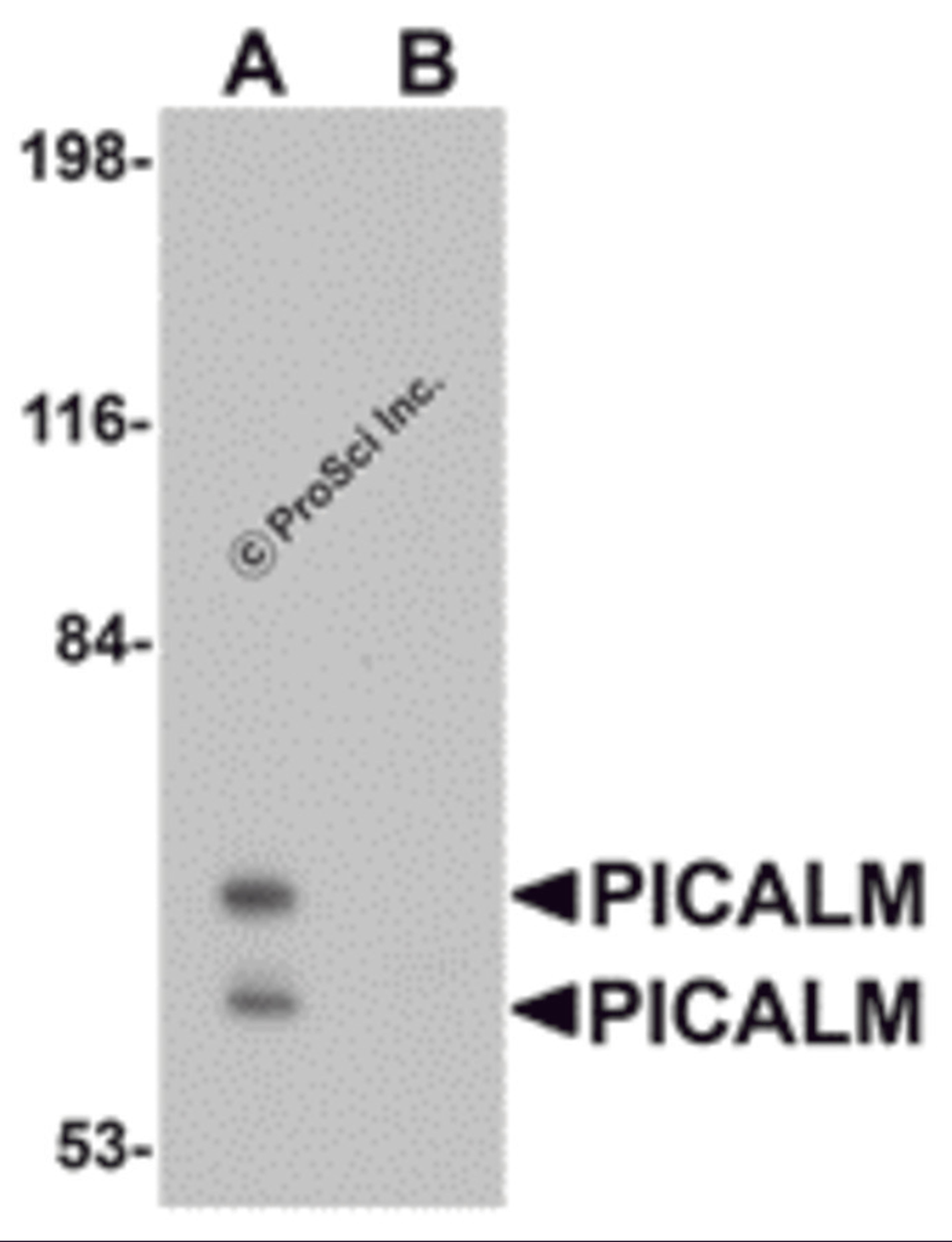 Western blot analysis of PICALM in EL4 cell lysate with PICALM antibody at 1 μg/mL in (A) the absence and (B) the presence of blocking peptide.