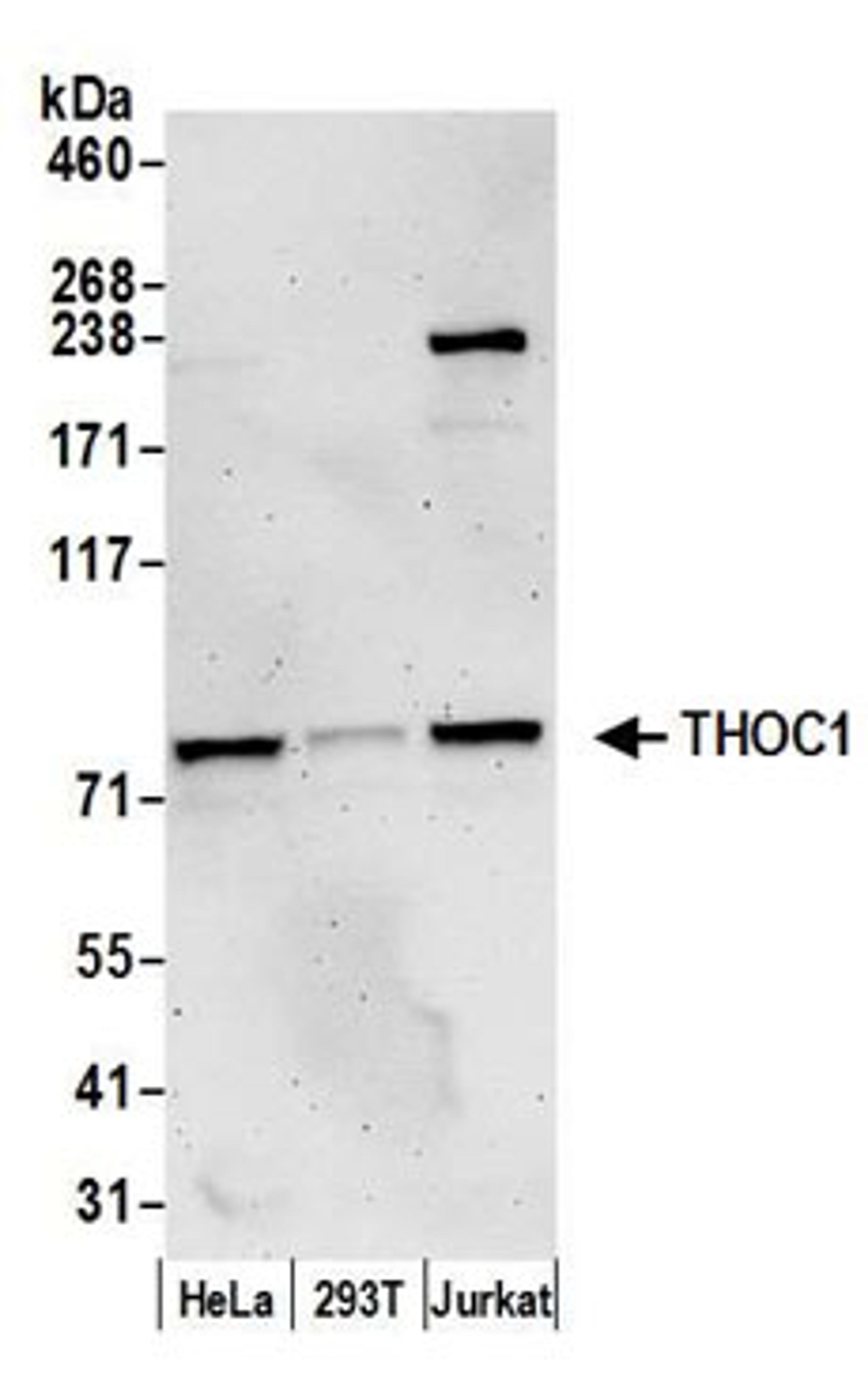 Detection of human THOC1 by western blot.