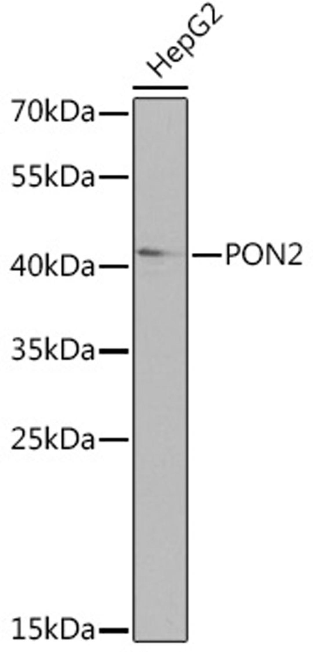 Western blot - PON2 Rabbit pAb (A14048)